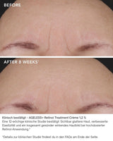 Ageless+ Retinol Treatment Crème 1,2 % Retinol Complex