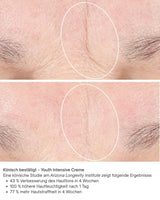 Vorher Nachher Bilder Youth Intensive Creme iS Clinical