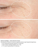 Vorher Nachher Bilder Youth Intensive Creme iS Clinical