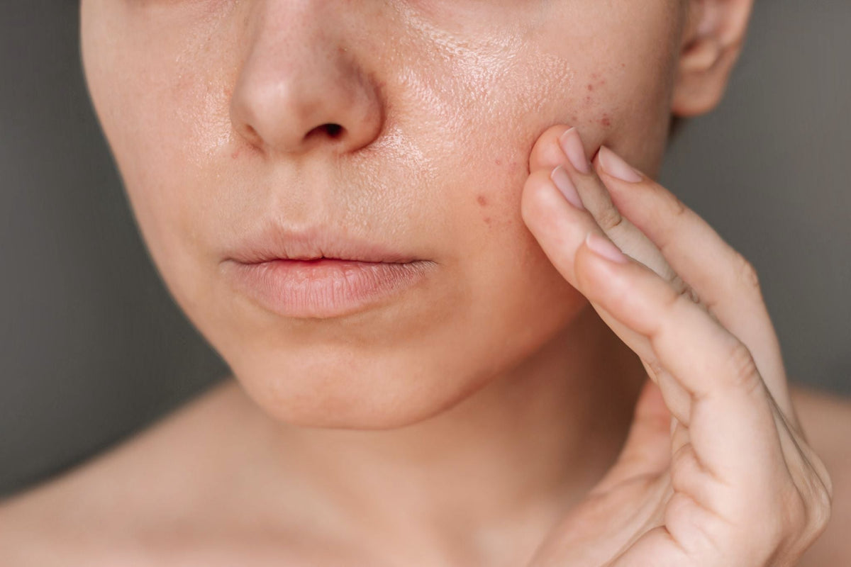 7 Skincare-Fehler, die ich immer wieder sehe – und wie du sie vermeidest