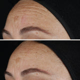AGELESS+ Retinol IMAGE Skincare - pure liquid 0,1% - vorher - nachher