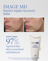 IMAGE MD Barrier Repair Recovery Balm