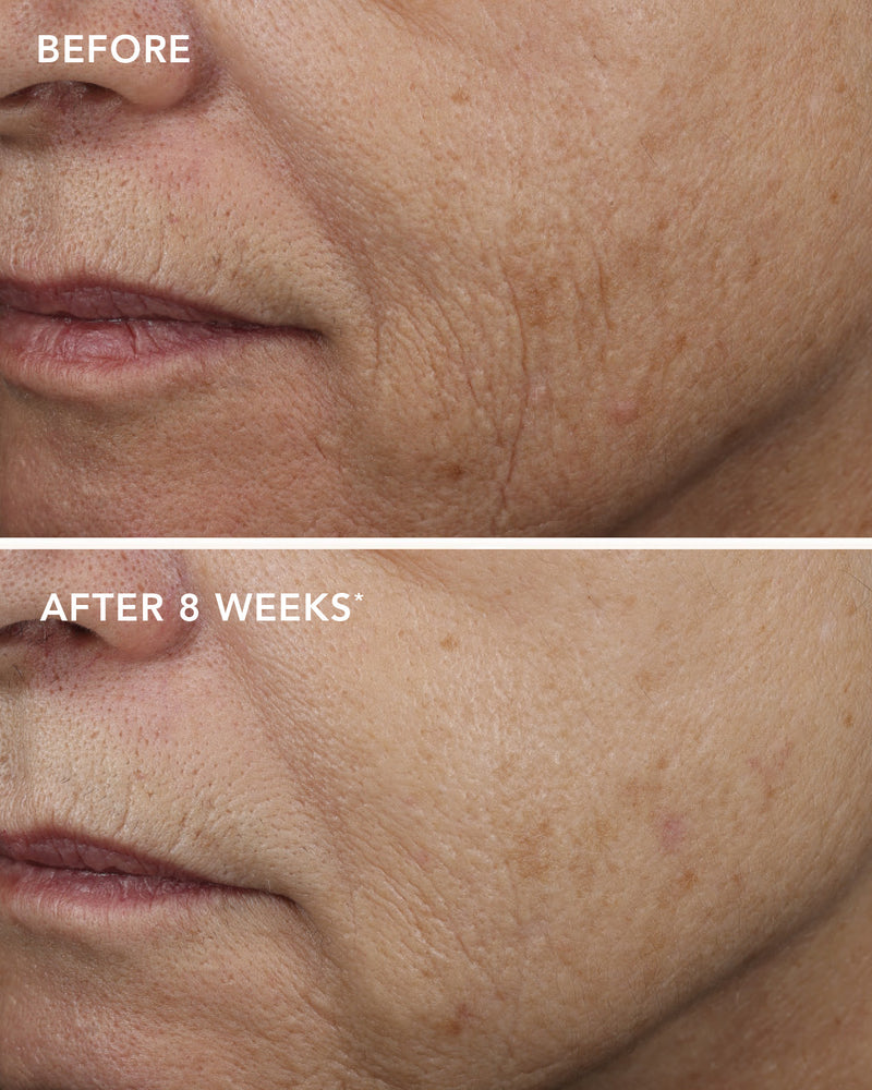Ageless+ Retinol von IMAGE Skincare - Vorher Nachher klinische Studie - Retinol Overnight Masque 0,5% Retinol Komplex