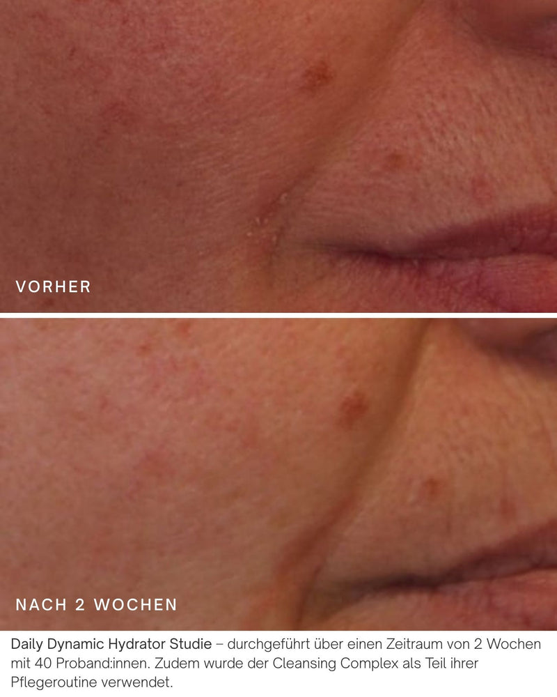 Vorher Nachher Daily Dynamic Hydrator Studie