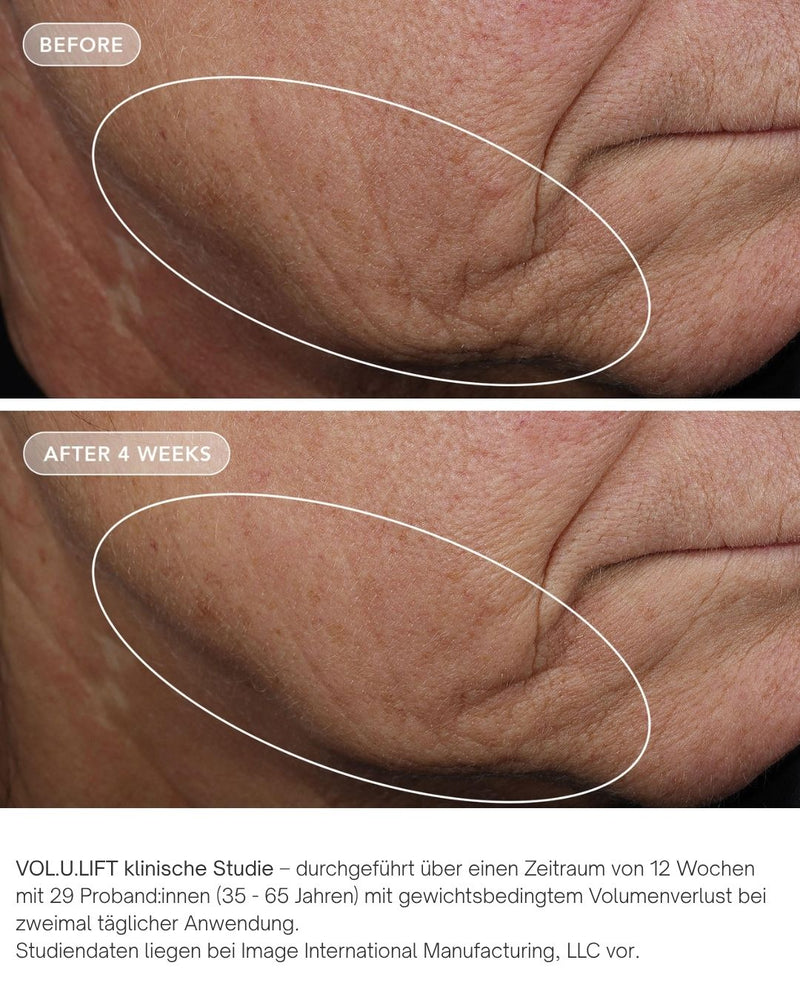Vol.U.Lift von IMAGE Skincare - glp-1 4D skin rebound complex vorher nachher klinische ergebnisse