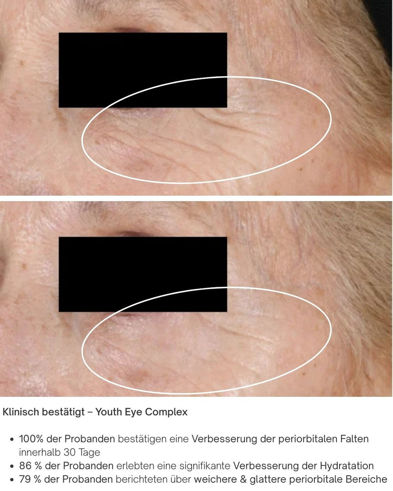 Youth Eye Complex