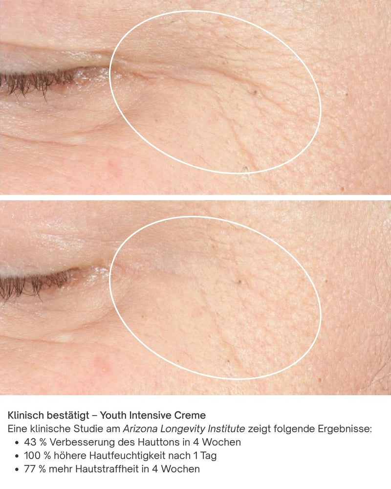 Vorher Nachher Bilder Youth Intensive Creme iS Clinical