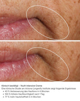 Vorher Nachher Bilder Youth Intensive Creme iS Clinical