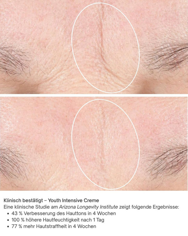 Vorher Nachher Bilder Youth Intensive Creme iS Clinical