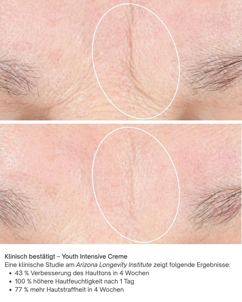 Vorher Nachher Bilder Youth Intensive Creme iS Clinical