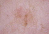 Pigment_before